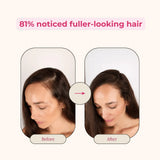 Creator Pack - Folly Hair Health Gummies