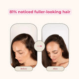 Creator Pack - Folly Hair Health Gummies