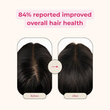 Creator Pack - Folly Hair Health Gummies