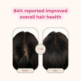 Creator Pack - Folly Hair Health Gummies