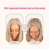 Creator Pack - Folly Hair Health Gummies