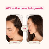 Creator Pack - Folly Hair Health Gummies