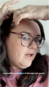 Hair Growth Gummies - Video 2